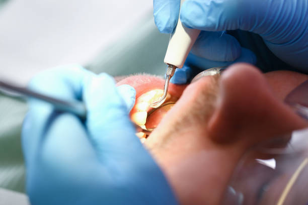 Best Emergency Cosmetic Dentistry (e.g., broken veneers) in English, IN