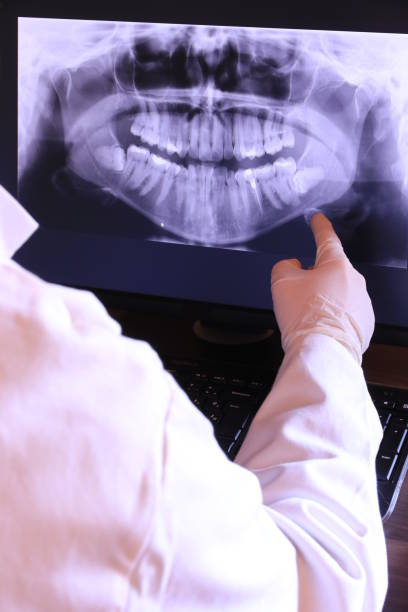 Best Broken or Chipped Tooth Repair in English, IN