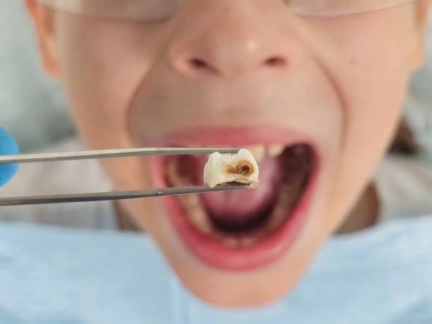  English, IN Emergency Dentist Pros