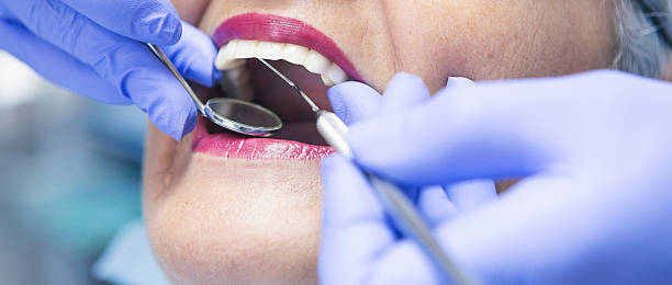 Best Walk-In Emergency Dental Services in English, IN